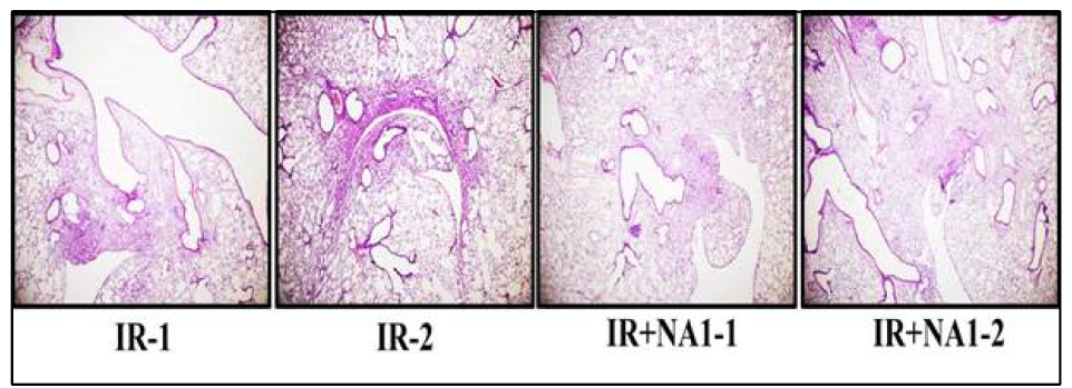 방사선 75 Gy 조사 후 HSP27 저해제 선도물질 NA1 투여한 폐조직의 H&E staining. 16주 후 마우스에서 적출한 폐조직을 관찰하기 위해 10% formaldehyde를 이용하여 고정시킨 후 H&E staining 하여 관찰함