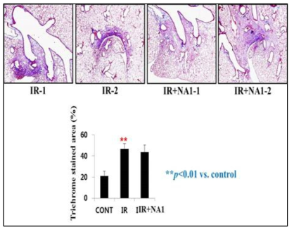 방사선 75 Gy 조사후 HSP27 저해제 선도물질 NA1 투여한 폐조직의 MT staining. 16주후 마우스에서 적출한 폐조직을 관찰하기 위해 10% formaldehyde를 이용하여 고정시킨 후 collagen 침착 특이 염색인 MT staining 하여 관찰함