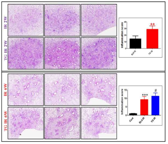 75Gy 방사선 선량에 의한 폐조직의 H&E staining. 방사선 조사 후 2주, 6주 후에 마우스에서 적출한 폐조직을 관찰하기 위해 10% formaldehyde를 이용하여 고정시킨 후 H&E staining 하여 관찰함. IR : Irradiated hsp27 Wild type mouse, TG IR : Irradiated hsp27 transgenic mouse