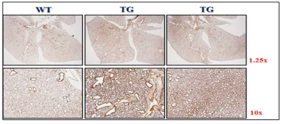 HSP27 wild type mouse (WT) 와 transgenic mouse (TG) 에서 HSP27 발현양 확인. 방사선 조사 전 마우스 폐를 이용하여 basal level에서의 HSP27의 발현량을 IHC로 확인함