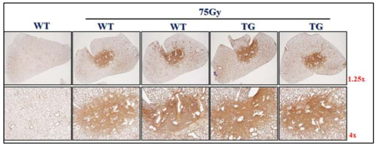 방사선 조사된 HSP27 wild type mouse (WT) 와 transgenic mouse (TG) 에서 HSP27 발현양 확인. 방사선 조사 후 마우스 폐를 이용하여 방사선에 의한 HSP27의 발현변화를 IHC로 확인함