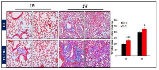 Massion’s Trichrome 염색을 통한 폐 손상평가. 마우스에 75Gy 방사선 조사 하고 1주 및 2주후에 마우스를 희생하여 Masson’s Trichrome 염색으로 collagen 침착을 관찰함. Transgenic mouse 그룹(TG+IR) 에서는 wildtype 그룹 (IR)에 비해 유의미하게 collagen이 침착되어 있어 섬유화가 진행되고 있음이 관찰됨