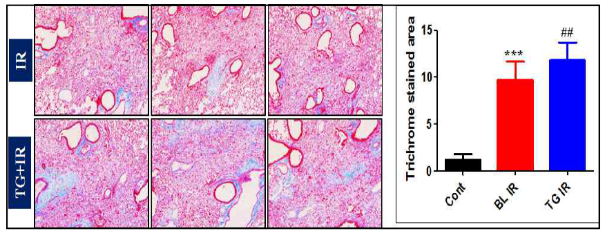 Massion’s Trichrome 염색을 통한 폐 손상평가. 마우스에 75Gy 방사선 조사 하고 6주후에 마우스를 희생하여 Masson’s Trichrome 염색으로 collagen 침착을 관찰함. Transgenic mouse 그룹(TG+IR) 에서는 wild type 그룹 (IR)에 비해 유의미하게 collagen이 침착되어 있어 Transgenic mouse엥서 섬유화가 더 많이 진행되고 있음이 관찰됨