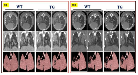 75Gy 방사선 조사 8일(왼쪽), 18일(오른쪽) 후 WT, Transgenic mouse에서 Micro-CT 측정 결과. 왼쪽 폐를 대상으로 Horizontal 또는 trans-axial orientation에서 consoldiation부분을 제외한 정상 폐조직의 volume을 측정한 결과 방사선 조사후 8일째 transgenic mouse에서 정상 폐 체적이 더 많이 감소되어 있음을 확인함. Top row : horizontal slice orientation. Middle row : trans-axial slice orientation. Bottom row : images of 3D micro-CT