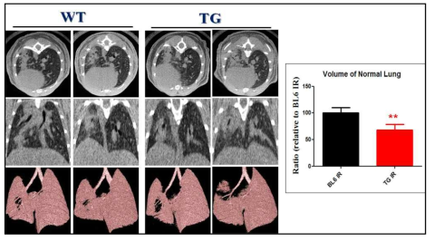 75Gy 방사선 조사 6주후 WT, transgenic mouse에서 micro-CT 측정 결과. 왼쪽 폐를 대상으로 Horizontal 또는 trans-axial orientation에서 consoldiation부분을 제외한 정상 폐조직의 volume을 측정한 결과 transgenic mouse에서 정상 폐 체적이 더 많이 감소되어 있음을 확인함. Top row : horizontal slice orientation. Middle row : trans-axial slice orientation. Bottom row : images of 3D micor-CT