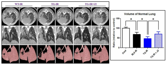 HSP27 유전자조작 마우스에서 Micro-CT 촬영을 통한 hsp27 억제 후보물질의 폐섬유화 억제 효능 평가. 왼쪽 폐를 대상으로 Horizontal 또는 trans-axial orientation에서 정상 폐조직의 volume을 측정한 결과 transgenic mouse에서 정상 폐 체적이 더 많이 감소되어 있음을 확인함. 그러나 HSP27억제 후보물질 (J2)를 투여한 마우스에서는 정상폐체적이 일부 회복되었음. Top row : horizontal slice orientation. Middle row : trans-axial slice orientation. Bottom row : images of 3D micor-CT