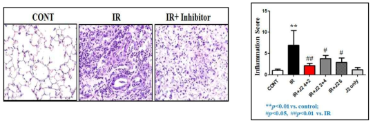 HSP27 억제 후보물질 처리한 폐조직의 H&E staining – Inflammation score 측정 결과. IR: 75Gy 방사선만 조사한 그룹, IR+J2 4+2: 75Gy 방사선 조사 직후 HSP27 억제 후보물질을 4주 동안만 처리한 그룹, IR+J2 2+4: 방사선 조사 후 2주 이후부터 HSP27 억제 후보물질을 4주 동안 만 처리한 그룹, IR+J2 6: 75Gy 방사선 조사 후 HSP27 억제 후보물질을 6주 동안 처리한 그룹, J2 only: HSP27 억제 후보물질만 6주 처리한 그룹