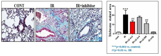 HSP27 억제 후보물질 처리한 폐조직의 Masson’s Trichrome staining 결과. IR: 75Gy 방사선만 조사한 그룹, IR+J2 4+2: 75Gy 방사선 조사 직후 HSP27 억제 후보물질을 4주 동안만 처리한 그룹, IR+J2 2+4: 방사선 조사 후 2주 이후부터 HSP27 억제 후보물질을 4주 동안만 처리한 그룹, IR+J2 6: 75Gy 방사선 조사 후 HSP27 억제 후보물질을 6주동안 처리한 그룹, J2 only: HSP27 억제 후보물질만 6주 처리한 그룹