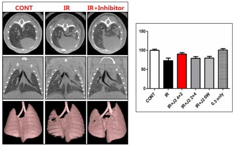 HSP27 억제 후보물질 처리한 마우스의 micro-CT 측정 결과. IR: 75Gy 방사선만 조사한 그룹, IR+J2 4+2: 75Gy 방사선 조사 직후 HSP27 억제 후보물질을 4주 동안만 처리한 그룹, IR+J2 2+4: 방사선 조사 후 2주 이후부터 HSP27 억제 후보물질을 4주 동안만 처리한 그룹, IR+J2 6: 75Gy 방사선 조사 후 HSP27 억제 후보물질을 6주 동안 처리한 그룹, J2 only: HSP27 억제 후보물질만 6주 처리한 그룹