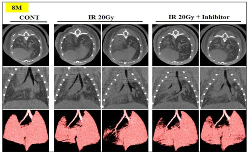 마우스 left-whole lung에 20Gy 방사선 조사 후 8개월 된 마우스의 Micro-CT 결과