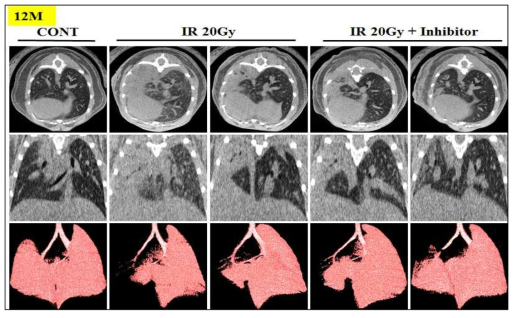 마우스 left-whole lung에 20Gy 방사선 조사 후 12개월된 마우스의 Micro-CT 결과