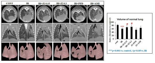 방사선 폐섬유와 마우스 모델에서 Micro-CT 결과를 통한 HSP27 억제 후보물질과 대조 약물 비교 결과. 왼쪽 폐를 대상으로 Horizontal 또는 trans-axial orientation에서 정상 폐조직의 volume을 측정한 결과 방사선에 의해 정상 폐 체적이 더 많이 감소되는 것이 HSP27 억제 후보물질(J2)를 투여한 그룹에서는 유의하게 정상폐체적이 회복되었음. 그러나 다른 대조약물에서는 그러한 효과가 없음을 확인하였음. Top row : horizontal slice orientation. Middle row : trans-axial slice orientation. Bottom row : images of 3D micor-CT