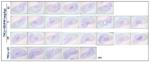 방사선 75 Gy 조사 후 HSP27 저해제 HSP49 및 J2를 투여한 폐조직의 H&E staining (10X)