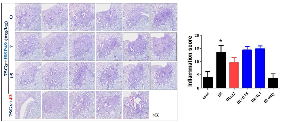 방사선 75 Gy 조사 후 HSP27 저해제 HSP49 및 J2를 투여한 폐조직의 H&E staining (40X) 및 Inflammation score. 마우스에서 적출한 폐조직을 관찰하기 위해 4% paraformaldehyde를 이용하여 고정시킴. 조직을 탈수과정을 통하여 paraffin block을 만듦. paraffin block으로 만든 조직을 microtome을 이용하여 4㎛ 로 자름. glass slide위에 조직을 올려, paraffin을 제거하고 Hematoxylin & Eosin (H&E) 염색을 함