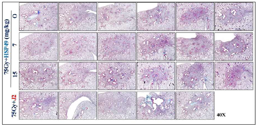 방사선 75 Gy 조사 후 HSP27 저해제 HSP49 및 J2를 투여한 폐조직의 H&E staining (10X)