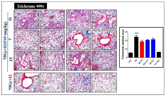 방사선 75 Gy 조사 후 HSP27 저해제 HSP49 및 J2를 투여한 폐조직의 H&E staining (40X) 및 Inflammation score. 마우스에서 적출한 폐조직을 관찰하기 위해 4% paraformaldehyde를 이용하여 고정시킴. 조직을 탈수과정을 통하여 paraffin block을 만듦. paraffin block으로 만든 조직을 microtome을 이용하여 4㎛ 로 자름. glass slide위에 조직을 올려, paraffin을 제거하고 Hematoxylin & Eosin (H&E) 염색을 함