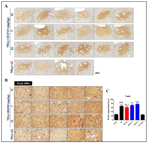 75Gy 방사선 조사 후 면역염색을 통한 twist 발현확인. 마우스의 왼쪽 폐에 75Gy의 방사선을 조사하고 J2와 HSP49를 처리한 마우스 폐조직에서 면역염색을 시행하였음. A: magnification 40X, B: magnification 400X, C: Graph of Twist expression level