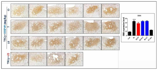 75Gy 방사선 조사 후 면역염색을 통한 a-SMA 발현확인. 마우스의 왼쪽 폐에 75Gy의 방사선을 조사하고 J2와 HSP49를 처리한 마우스 폐조직에서 면역염색을 시행하였음