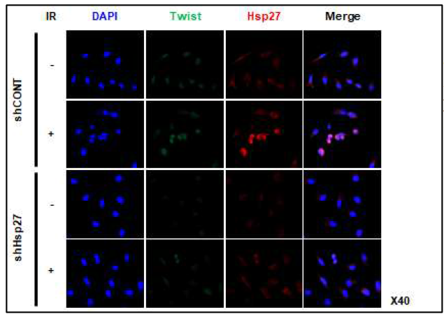 shControl 및 shHSP27이 이식된 L132 정상폐세포에 방사선 5Gy를 조사하고 Twist 및 HSP27의 발현을 면역형광염색으로 관찰
