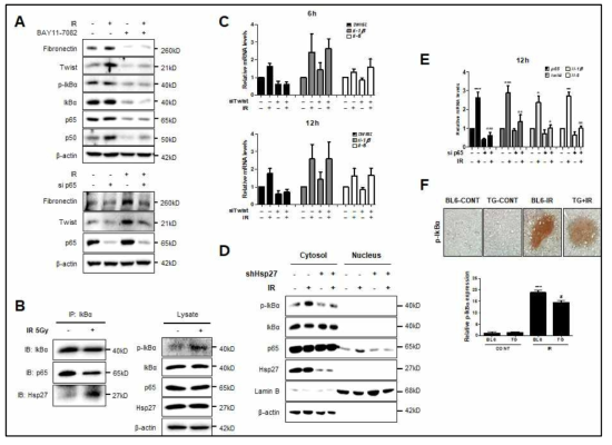 NFkB 저해제 BAY11-7082 처리 또는 sip65 transfection을 L132세포에 한 후 Western blotting한 결과 (A). IkBalpha와 HSP27의 결합에 대한 면역침전법 (IP) (B). siTwist를 L132세포에 처리한 후 qRT-PCR를 통한 IL-1beta 및 IL-6의 정량 (C). shHSP27을 stably 처리한 L132세포에서 cytosol과 nucleus를 분리한 후 Western blotting 한 결과 (E). L132 정상 폐세포에 sip65를 처리한 후 qRT-PCR 결과 (E). 정상마우스 및 HSP25 TG 마우스에 방사선 75Gy를 조사한후 폐조직을 대상으로 p-IkBalpha에 대한 면역염색결과 (F)