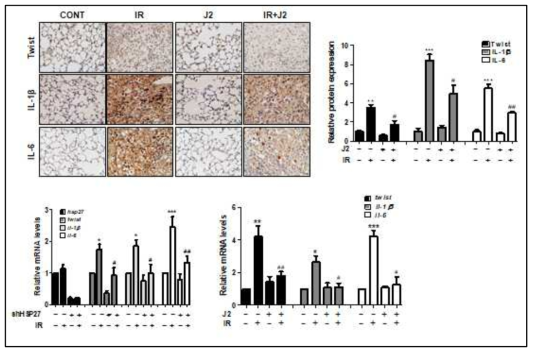방사선 조사 (75 Gy) 폐조직에서 J2 처리유무에 따른 Twist, IL1-beta, IL-6의 발현을 면역염색으로 관찰하고 염색된 세포의 정량화 (위). L132 폐세포에 hsHSP27을 transfection한 후 방사선에 의한 Twist, IL-1beta, 및 IL-6의 발현을 qRT-PCR로 측정
