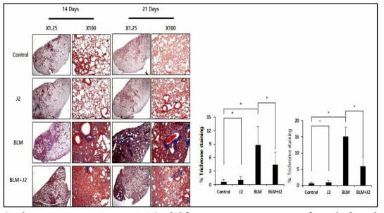Bleomycin (2.5 mg/kg)을 마취후 intrachiral administration후 14일 및 21일에 부검하였고 J2 (3mg/kg)를 복강내 2일에 한번씩 주사하였음. 폐를 적출하여 Trichrom 염색을 실시함 (좌) 파란색으로 염색된 부분을 정량화 한 그림 (우)