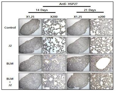 Bleomycin (2.5 mg/kg)을 마취후 intrachiral administration후 14일 및 21일에 부검하였고 J2 (3 mg/kg)를 복강내 2일에 한번씩 주사하였음. 폐를 적출하여 HSP27 단백질 발현을 면역염색