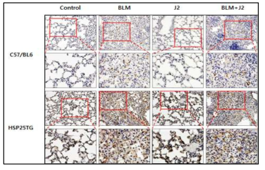 HSP25 TG마우스에 Bleomycin (1.25 mg/kg)을 마취후 intrachiral administration후 14일 및 21일에 부검하였고 J2 (15 mg/kg)를 복강내 2일에 한번씩 주사하였음. 폐를 적출하여 HSP27 단백질 발현을 면역염색