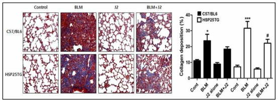정상마우스 및 HSP25 TG 마우스에 Bleomycin (1.25 mg/kg)을 마취후 intrachiral administration후 14일 및 21일에 부검하였고 J2 (15mg/kg)를 복강내 2일에 한번씩 주사하였음. 폐를 적출하여 Trichrom 염색을 실시함 (좌) 파란색으로 염색된 부분을 정량화 한 그림 (우)