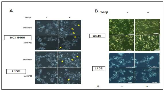 NCI-H460 및 L132세포에 (shControl) shHSP27을 stable하게 knock down한 세포 (shHSP27)를 제작한 후 5nM TGFbeta 또는 방사선 처리 48 시간 후 세포모양을 현미경으로 관찰한 그림
