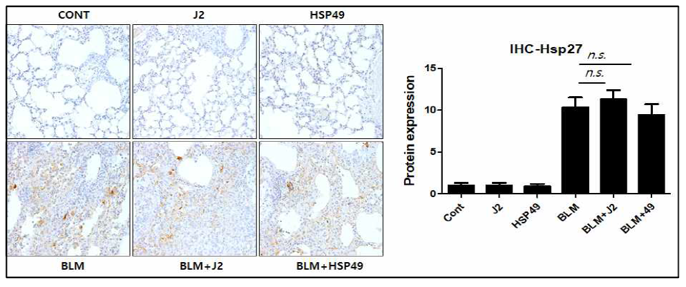 BLM에 의한 폐섬유화 모델에서 HSP27의 발현정도를 immunohistochemistry로 확인함