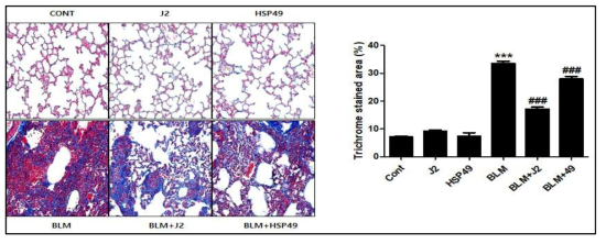 BLM에 의한 폐섬유화 모델에서 J2 및 HSP49 처리에 의한 Collagen 축적능을 Tichrome 염색으로 확인함