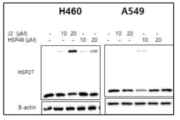 NCI-H460세포 및 A549 폐세포에서 J2 및 HSP49의 HSP27 비정상적 이형체 형성능을 Western blotting으로 비교