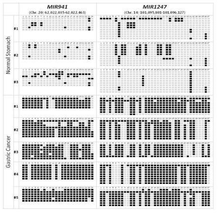 정상 위조직과 위암 조직에서의 Bisulfite sequencing을 이용한 MIR941과 MIR1247의 DNA methylation 상태 확인. 검은 상자는 Methylation을, 회색 상자는 Unmethylation을 나타냄