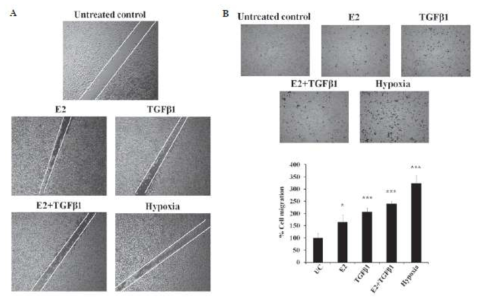 Estradiol, TGF-b1, Hypoxia를 각각 처리한 군에서 Wound-healing migration (A)과 Transwell migration (B)을 확인함