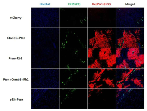 간세포암 (Hepatocellular carcinoma) 와 담관암 (Cholangiocarcinoma) 생성