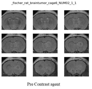 치료전 F98 rat glioma 모델의 MRI 영상/ 조영제 투여전(위)후(아래)