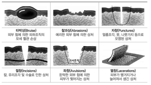 Classified according to the cause of the wound