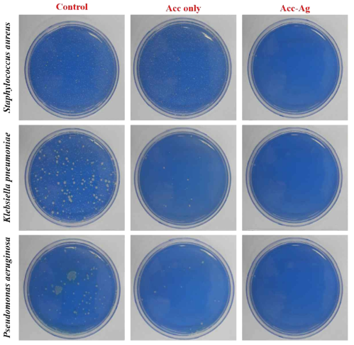 Antimicrobial test of activated carbon-silver composite particles