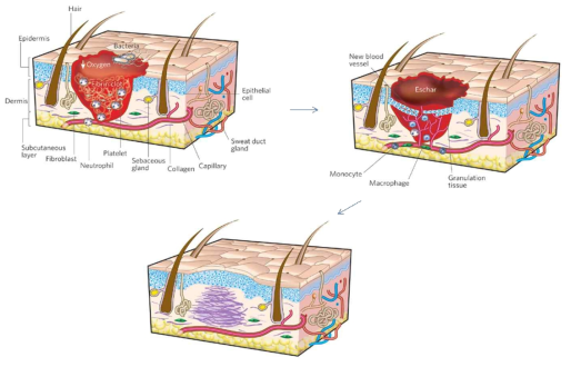 Wound site regeneration step