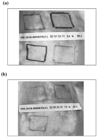 Photographs of rabbit skin after application of test materials; (a) 24 h and (b) 72 h respectively