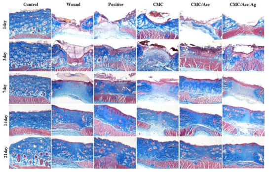 Evaluation of histopathology in the healing effect of ointments on wound induced skin damage using Masson’s trichrome stain (x 40)