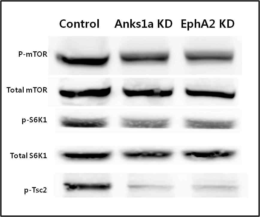 Anks1a KD 세포주에서의 mTOR signaling 활성화 비교