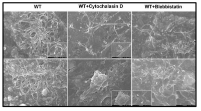 일차 뇌실막조직 세포에서 ECV 형성에 있어서 actin polymerization의 중요성