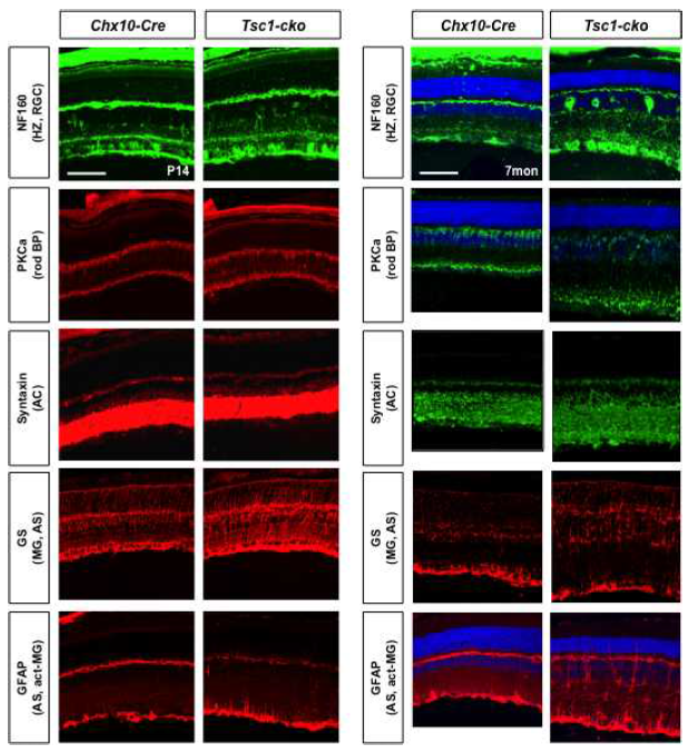 Tsc1-cko 생쥐 망막 신경네트워크 형성 이상
