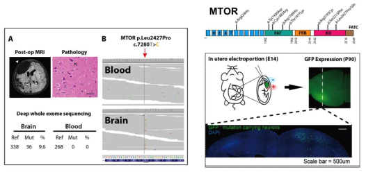 난치성 뇌전증 환자에서의 뇌 특이적 체성 유전변이 발굴 및 동물 모델 증명 데이터 (Lim et al Nature Medicine, 2015)