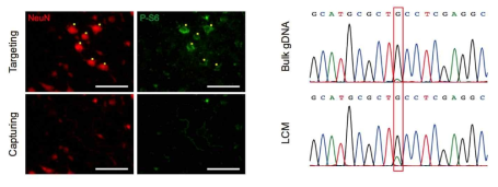 NeuN (neuronal marker), P-S6 (mTOR major readout) antibody를 이용하여 환자의 동결절편 조직에서 statining을 시행하였고 P-S6 postive cell 선택하여 laser capture 시행함