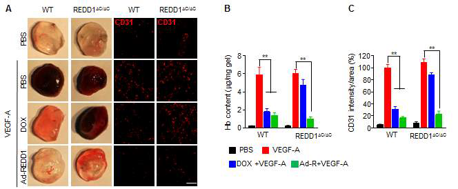 DOX에 의한 in vivo 혈관신생 억제 효과는 REDD1-결손 마우스에서 회복됨