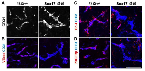 내피-특이 Sox17 결핍이 뇌종양 암혈관에 주는 구조적 변화
