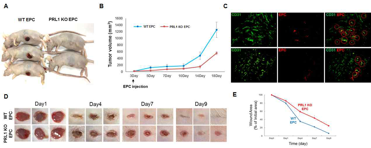EPC에서 PRL1 발현 저해에 따른 종양 성장 및 병리적 혈관신생 분석